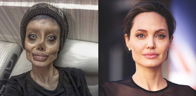 Elle subit 50 chirurgies pour ressembler à Angelina Jolie Elle subit 50 chirurgies pour ressembler à Angelina Jolie