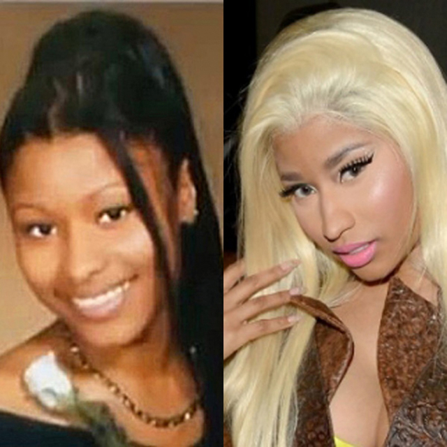 Nicki Minaj avant/aprés